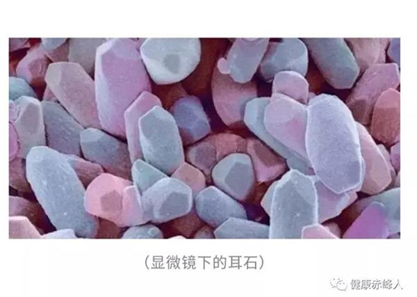 耳石为什么会脱落呢?
